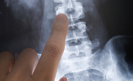 Balance Rückenzentrum Diagnostik